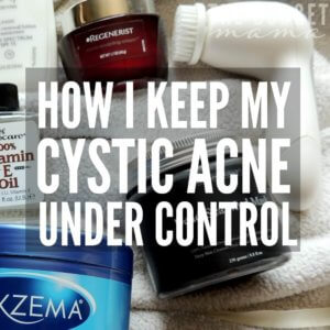 I've suffered from cystic acne since I was a teenager and now in my 30s, I've finally figured out how to keep cystic acne under control.