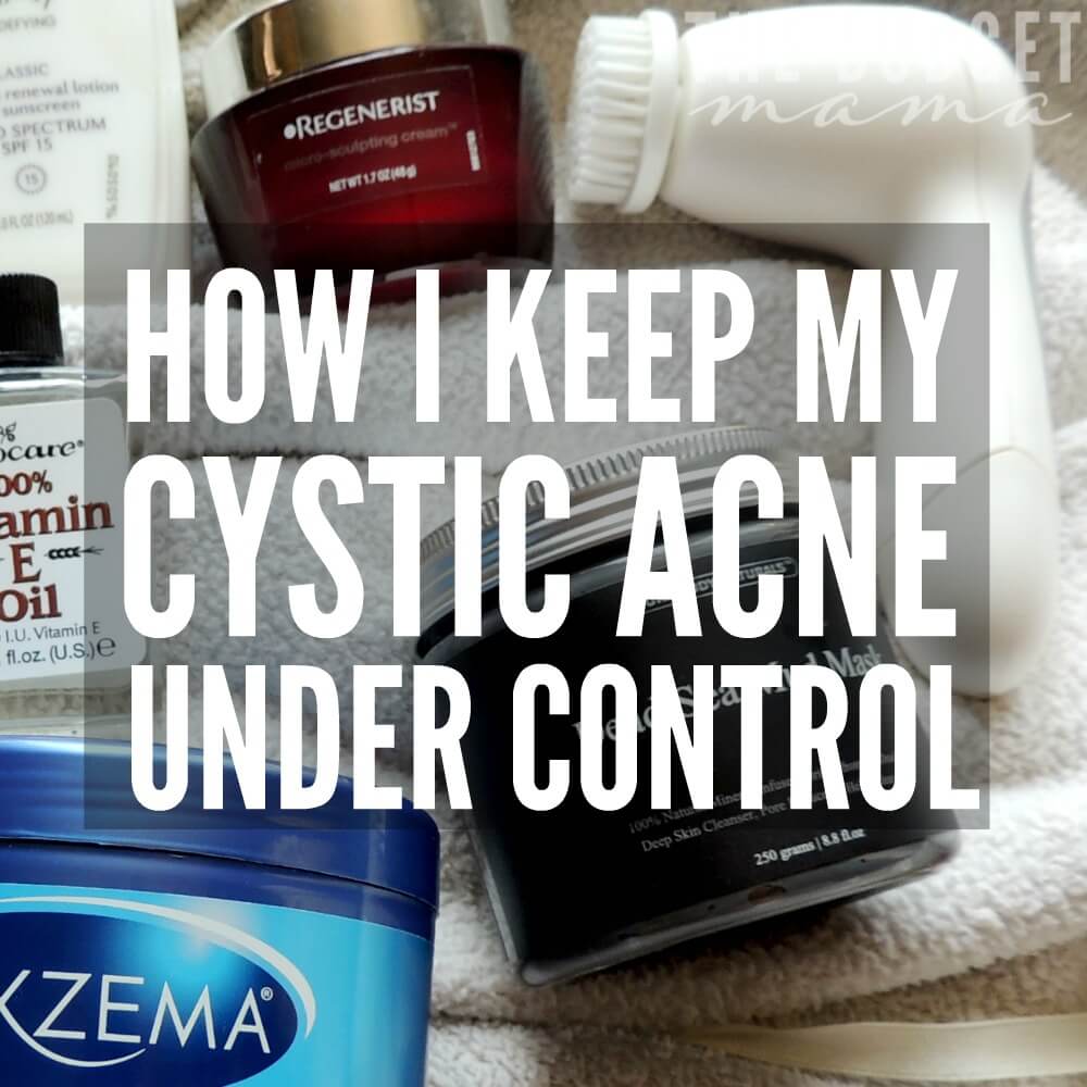 I've suffered from cystic acne since I was a teenager and now in my 30s, I've finally figured out how to keep cystic acne under control.